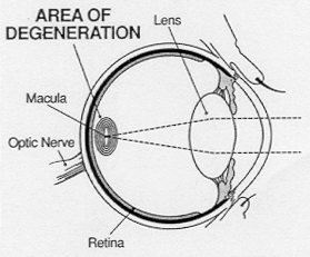 Optelec, Low Vision, Customer Service, Customer Service, Customer Service, Glaucoma, Diabetic Retinopathy, Low Vision Aids, Visually Impaired